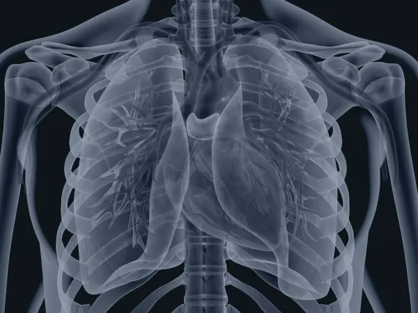 Cardiothoracic transplantation